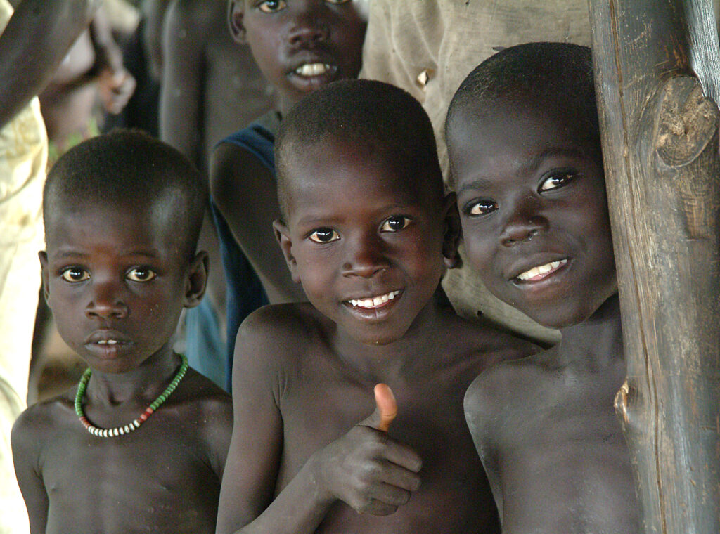 Severe Malnutrition and Health Crisis​